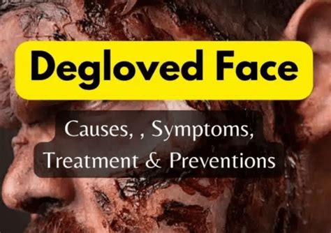 what causes degloved face